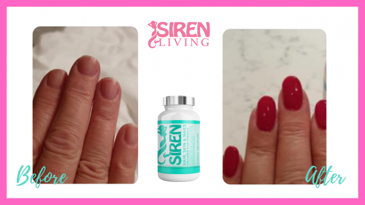 Amazing results from taking Siren Living Hair, Skin and Nail capsules